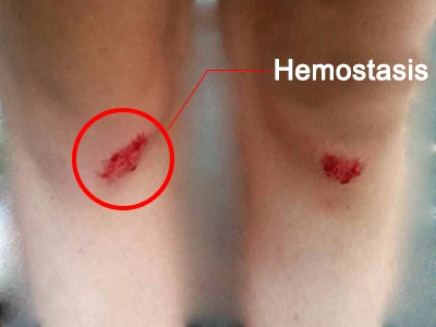 Glyceryl glucoside liquid heals wounds
