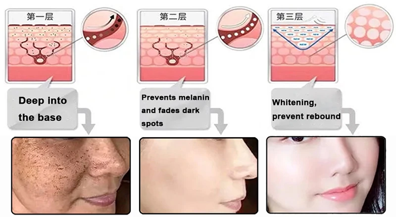 Symwhite Whitening